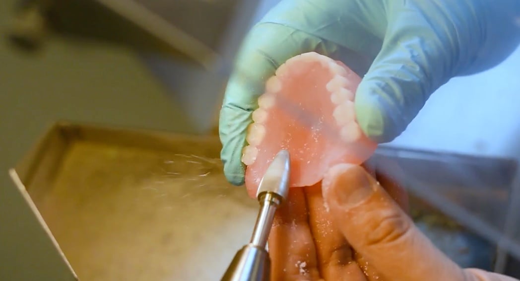 THE TEN STEPS TO DENTURE FABRICATION
